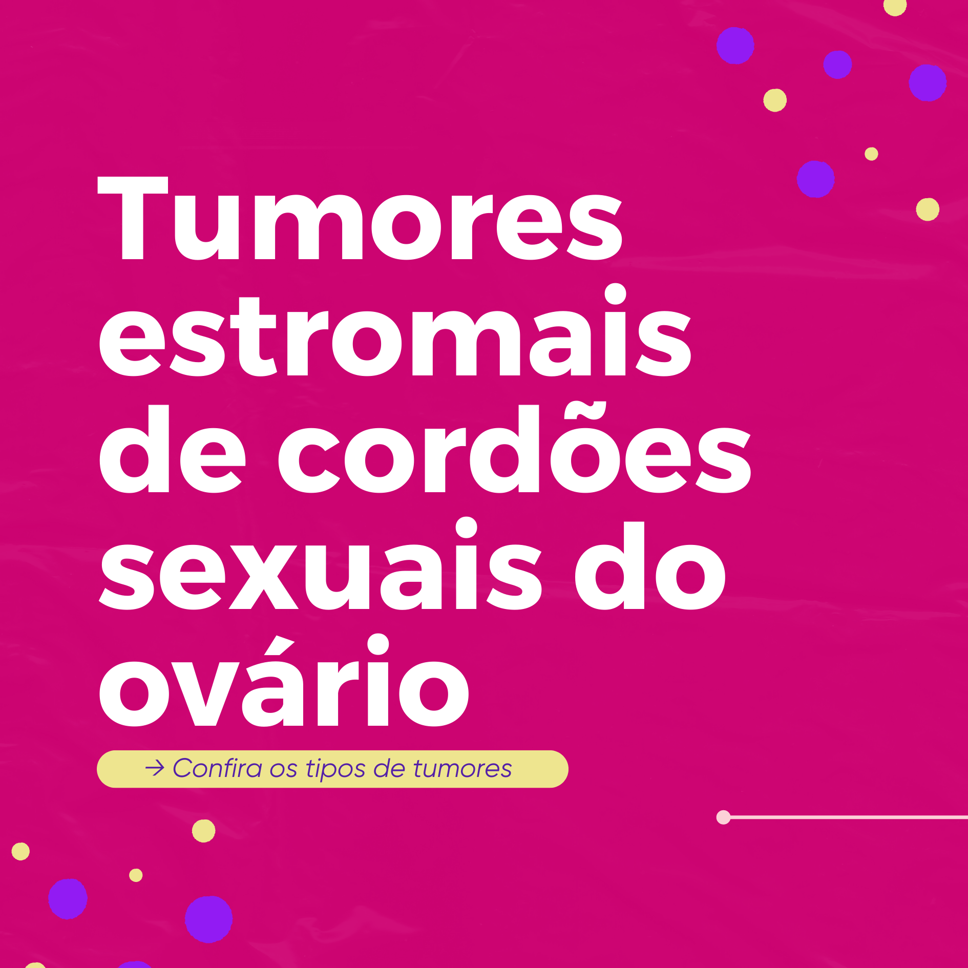 Tumores estromais de cordões sexuais do ovário